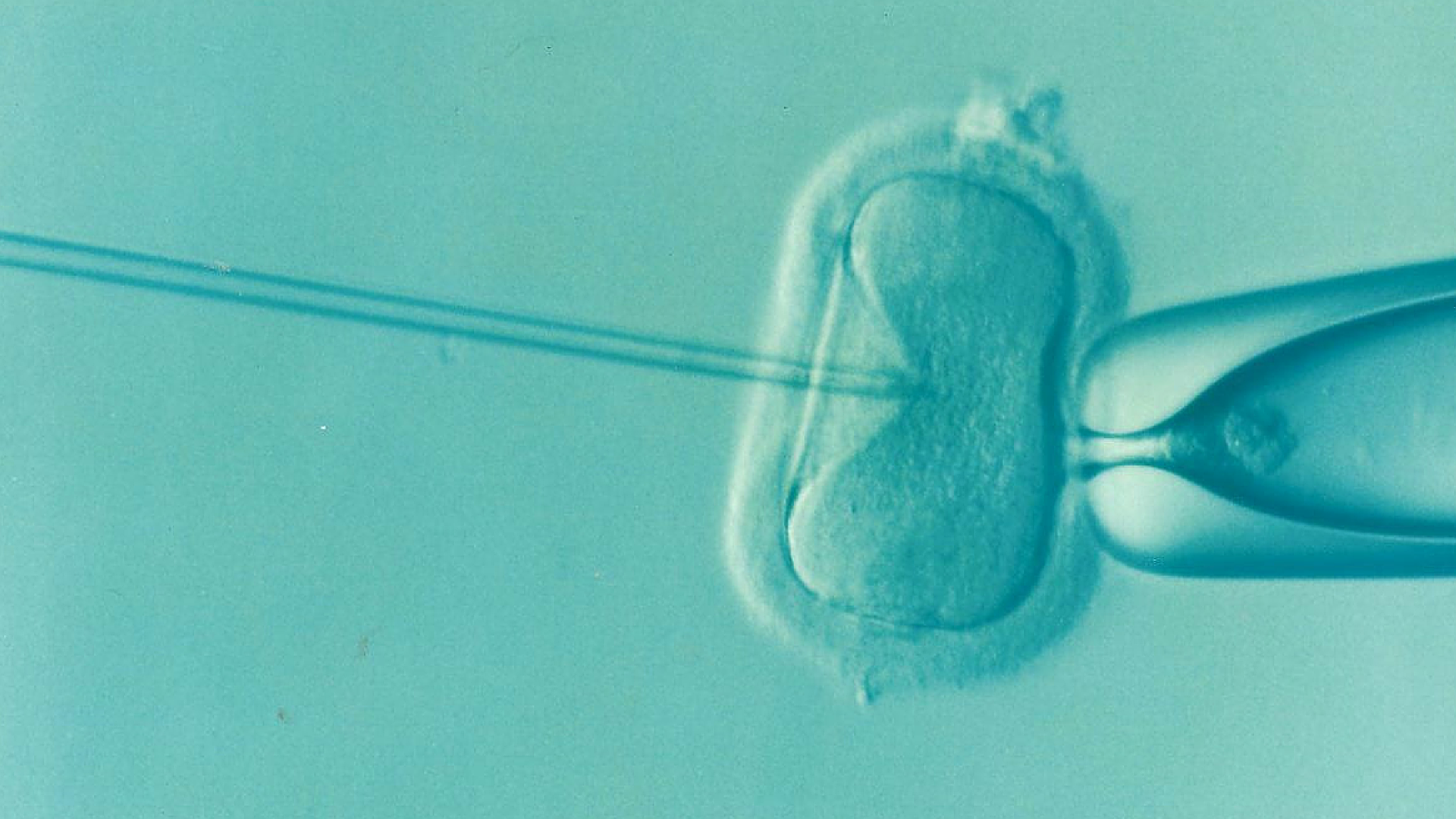 IVF for single woman Australia